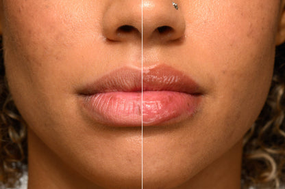 The Lip Plumper - Award-Winning Plumper with Peptides